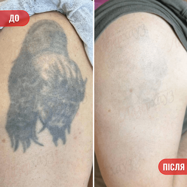 НАШІ РЕЗУЛЬТАТИ ДО ТА ПІСЛЯ