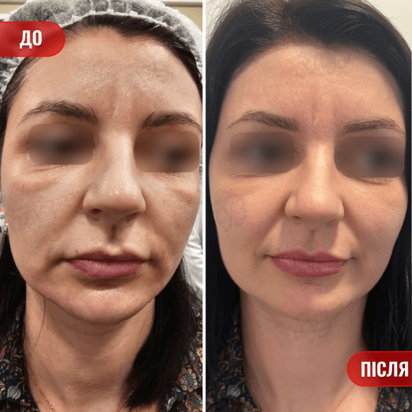 НАШІ РЕЗУЛЬТАТИ ДО ТА ПІСЛЯ