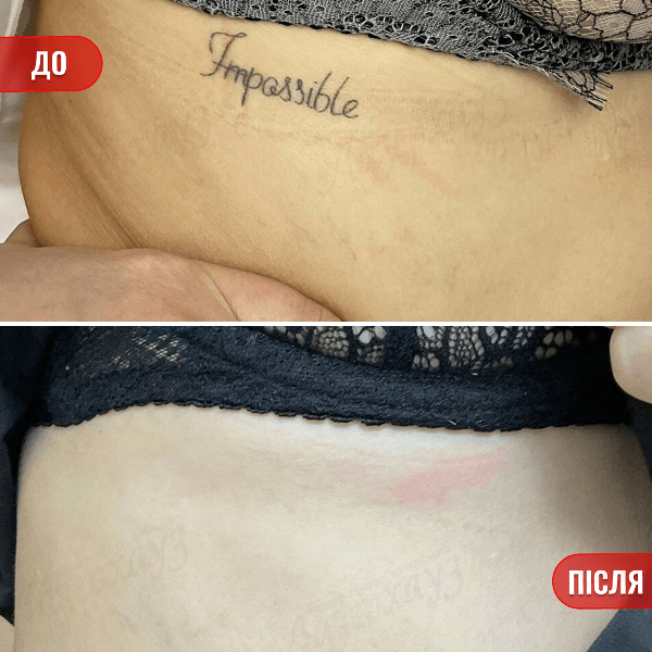 НАШІ РЕЗУЛЬТАТИ ДО ТА ПІСЛЯ