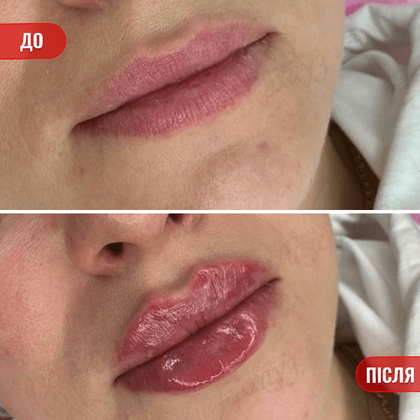 НАШІ РЕЗУЛЬТАТИ ДО ТА ПІСЛЯ