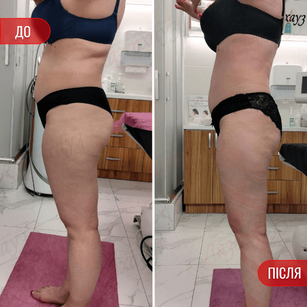 НАШІ РЕЗУЛЬТАТИ ДО ТА ПІСЛЯ