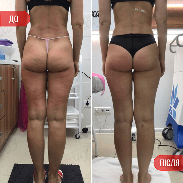 НАШІ РЕЗУЛЬТАТИ ДО ТА ПІСЛЯ