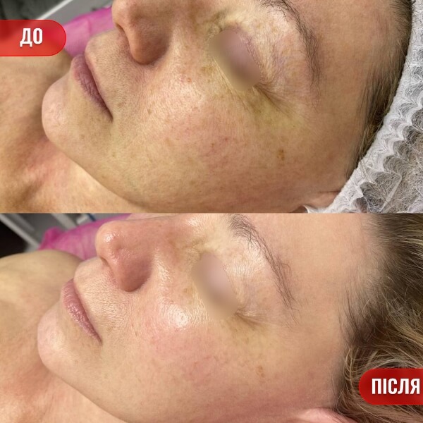 НАШІ РЕЗУЛЬТАТИ ДО ТА ПІСЛЯ