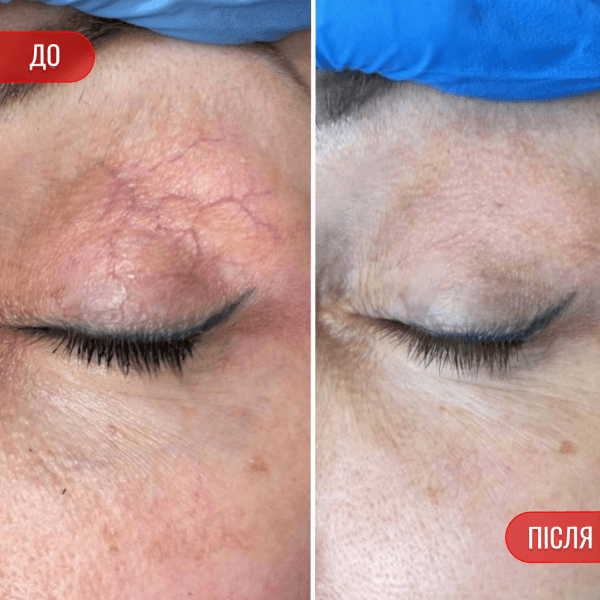 НАШІ РЕЗУЛЬТАТИ ДО ТА ПІСЛЯ