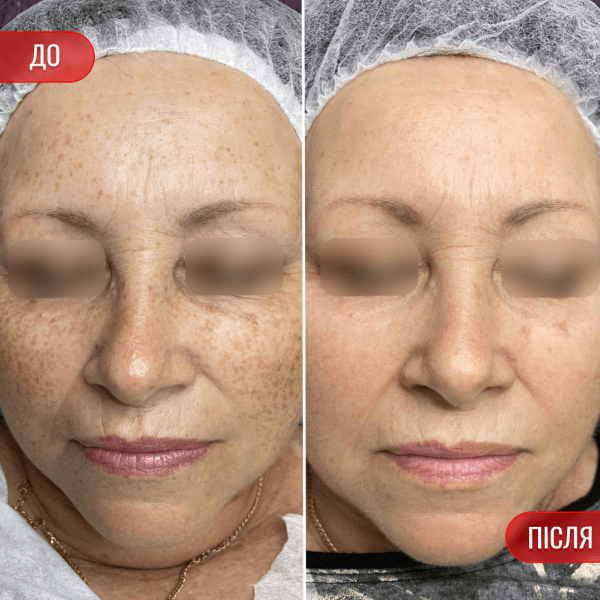 НАШІ РЕЗУЛЬТАТИ ДО ТА ПІСЛЯ