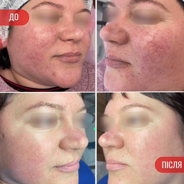 НАШІ РЕЗУЛЬТАТИ ДО ТА ПІСЛЯ