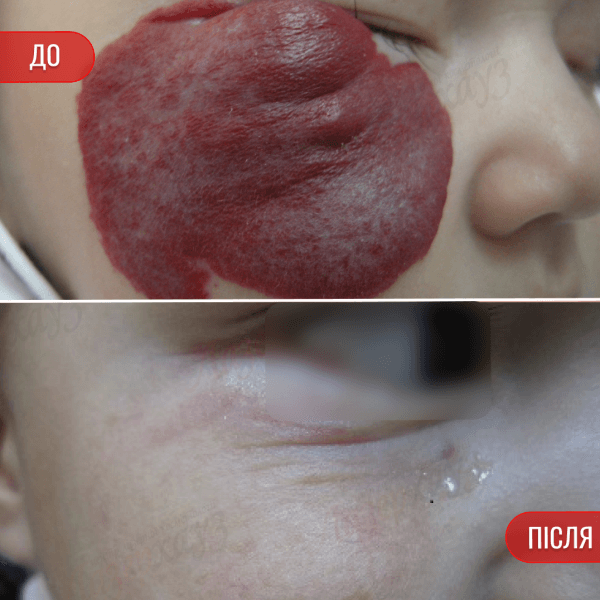 НАШІ РЕЗУЛЬТАТИ ДО ТА ПІСЛЯ