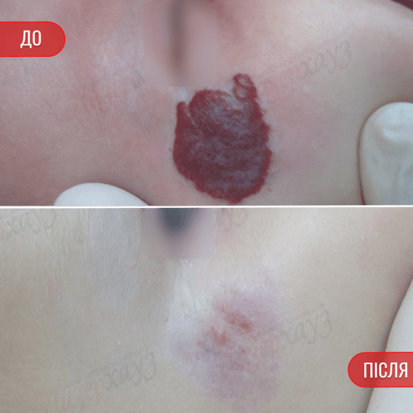 НАШІ РЕЗУЛЬТАТИ ДО ТА ПІСЛЯ