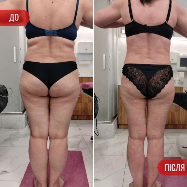 НАШІ РЕЗУЛЬТАТИ ДО ТА ПІСЛЯ