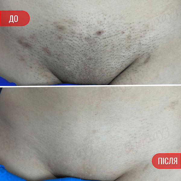 НАШІ РЕЗУЛЬТАТИ ДО ТА ПІСЛЯ