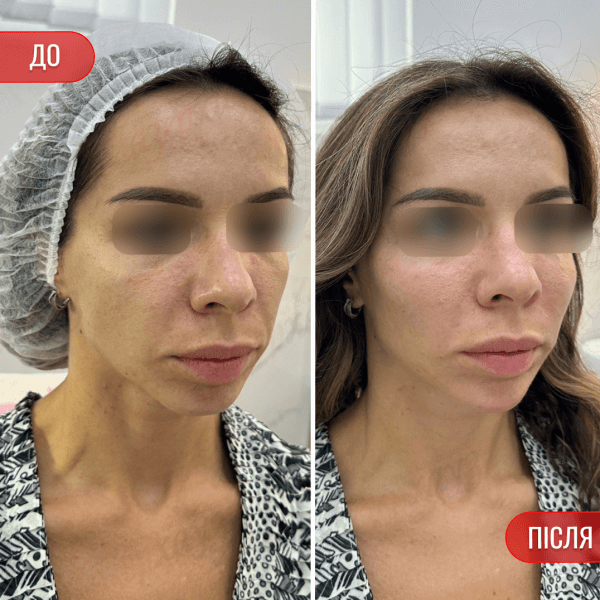 НАШІ РЕЗУЛЬТАТИ ДО ТА ПІСЛЯ