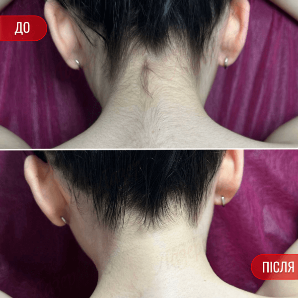 НАШІ РЕЗУЛЬТАТИ ДО ТА ПІСЛЯ