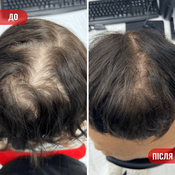 НАШІ РЕЗУЛЬТАТИ ДО ТА ПІСЛЯ