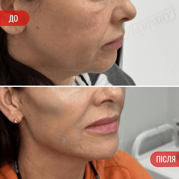 НАШІ РЕЗУЛЬТАТИ ДО ТА ПІСЛЯ