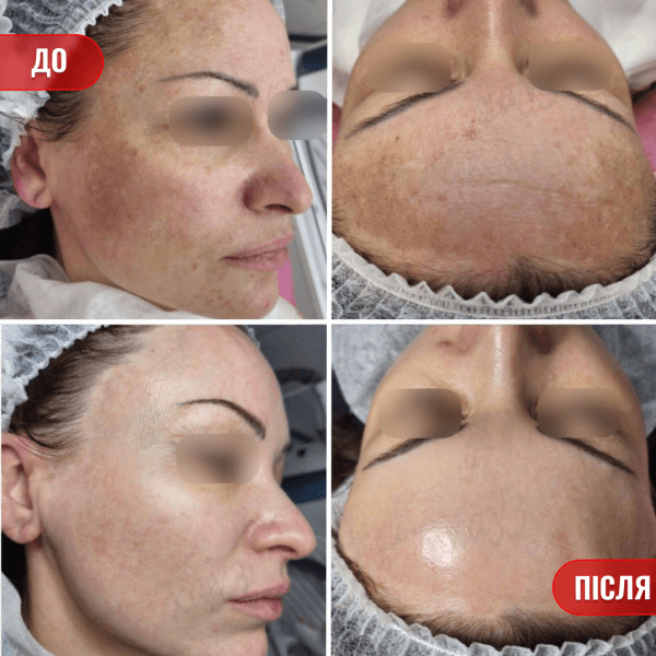 НАШІ РЕЗУЛЬТАТИ ДО ТА ПІСЛЯ