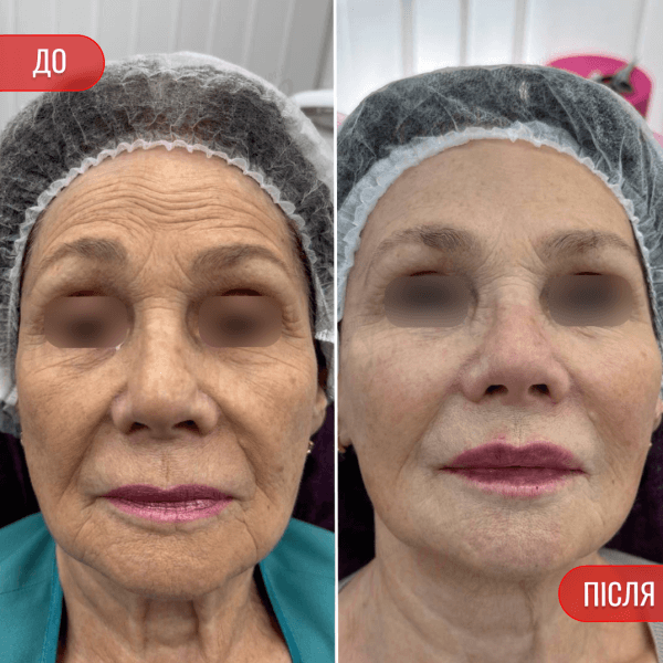 НАШІ РЕЗУЛЬТАТИ ДО ТА ПІСЛЯ