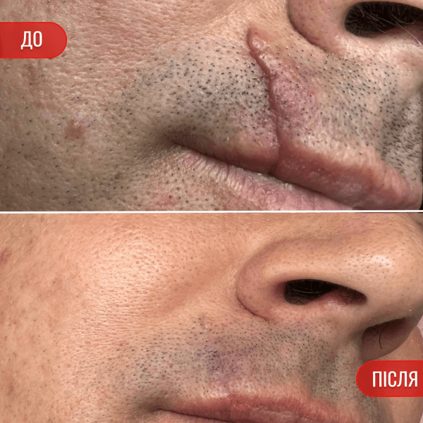 НАШІ РЕЗУЛЬТАТИ ДО ТА ПІСЛЯ