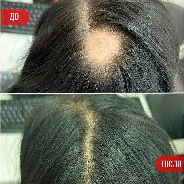 НАШІ РЕЗУЛЬТАТИ ДО ТА ПІСЛЯ