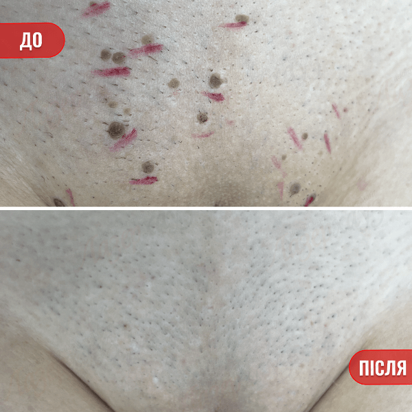 НАШІ РЕЗУЛЬТАТИ ДО ТА ПІСЛЯ