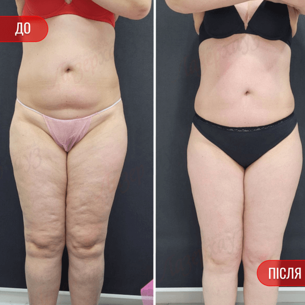 НАШІ РЕЗУЛЬТАТИ ДО ТА ПІСЛЯ