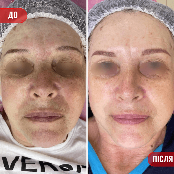 НАШІ РЕЗУЛЬТАТИ ДО ТА ПІСЛЯ