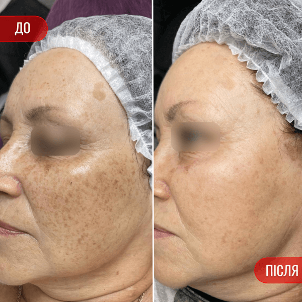 НАШІ РЕЗУЛЬТАТИ ДО ТА ПІСЛЯ
